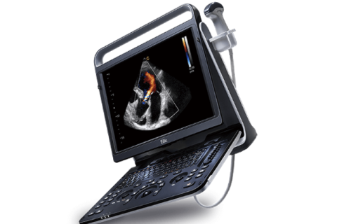 Chison EBit 60 – Portable Ultrasound System