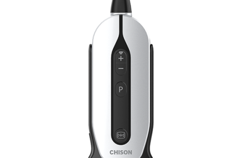 CHISON SonoEye P2